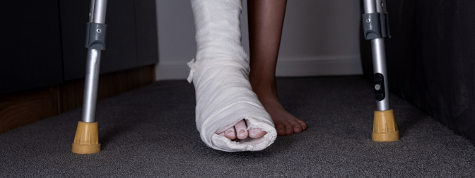 Pessoa com perna engessada utilizando muletas para caminhar, representando a necessidade de empréstimo gratuito de muletas